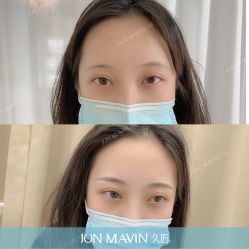 -久匠·纹眉半永久野生眉