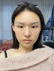 -韩辰医疗整形美容医院