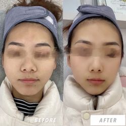 -慕颜医疗美容·皮肤微整 抗衰