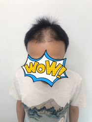 -发饰美男士增发补发假发定制店