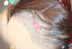 -大麦微针植发全国连锁