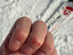 -北京西山滑雪场