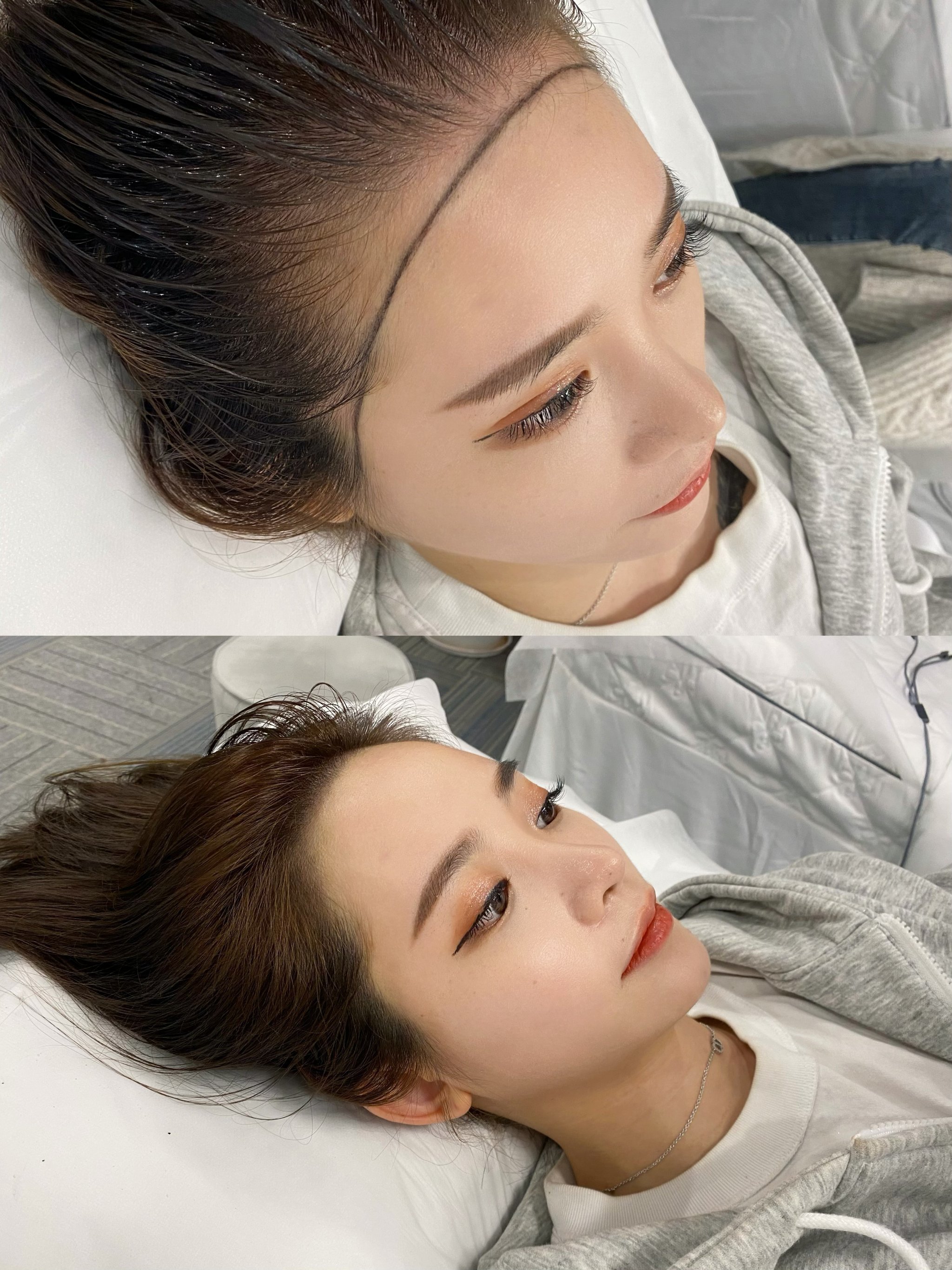 给犹豫纹发际线的姐妹5句大实话