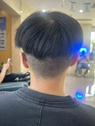 -大麦微针植发全国连锁