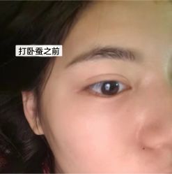 -上海伊莱美医疗美容医院