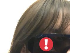 -黑马眼科·近视手术