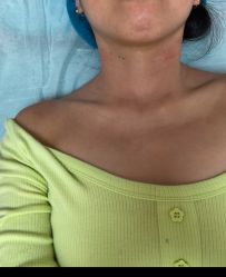 体验前-深圳米兰柏羽医疗美容医院