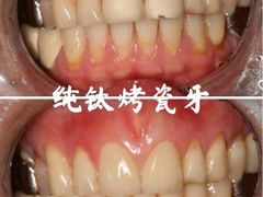 -团圆口腔·种植中心(锦江院区)