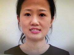 -宁波壹加壹口腔·矫正种植中心