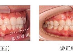 -Dr.Z dental仁康种植矫正中心