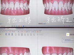 -爱雅仕口腔·数字化矫正中心(国贸门诊)