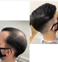 -发饰美男士增发补发假发定制店