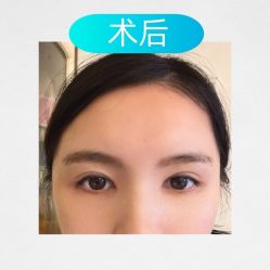 -素美医疗美容·西南眼鼻整形·修复基地