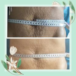 -亮丽妈妈·催乳通乳·产后恢复(万达店)