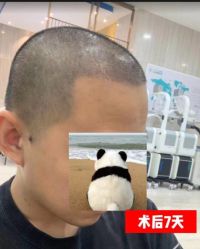 -雍禾植发全国连锁