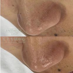 -凡碧诗毛孔收细
