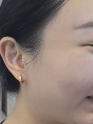 -长沙雅美医疗美容医院