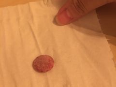 开出来的结石-甄爱宠物医院(疏影路店)