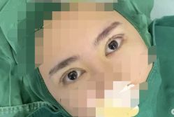 -东莞西妃整形美容医院