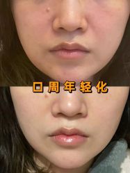 -倩极·精研痘敏肌管理