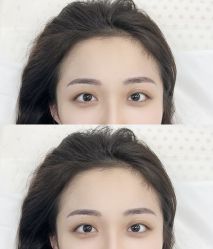 -张小野·专业半永久纹眉
