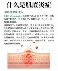 点击看大图 -MLP美丽派·问题肌疗愈中心