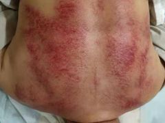 -承启堂中医馆·推拿·针灸(成华馆)