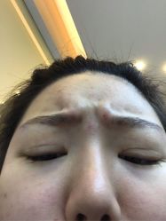 -More摩尔医美の注射线雕光电中心