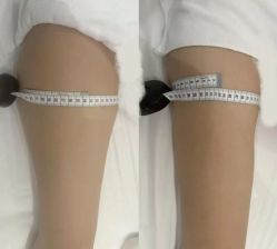 -Lily纤美·科技减脂中心