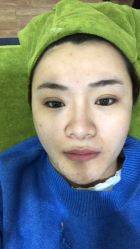 -苗方清颜痘肌研究所