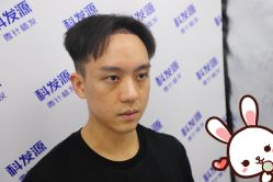 -大麦微针植发丨全国连锁