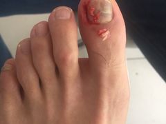 -新甲连锁灰指甲·甲沟炎·鸡眼(黑龙江路店)