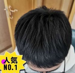 -大麦微针植发丨全国连锁