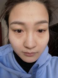 体验前-澳尔颜选医疗美容