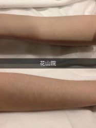 -觅屿日式脱毛美肤