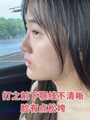 -苏州维多利亚美容医院