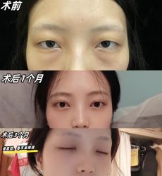 -素美医疗美容·西南眼鼻整形·修复基地