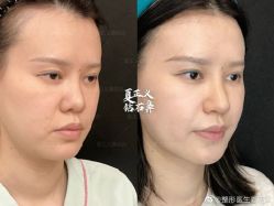 -北京米扬丽格医疗美容·联合丽格鼻整形中心