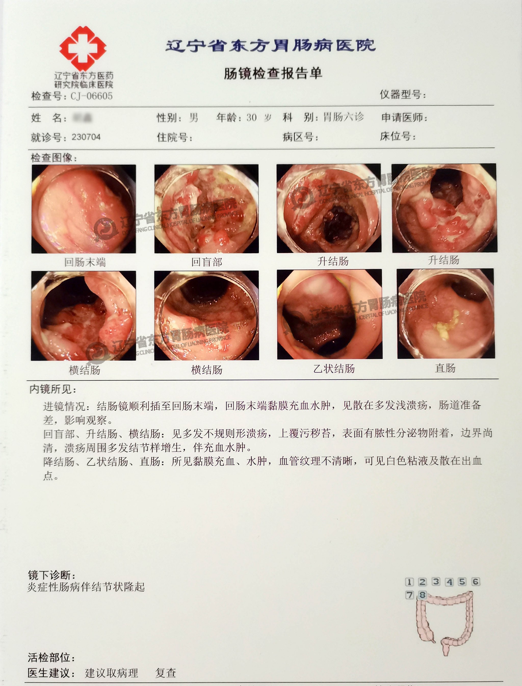 肠镜正常结果图片图片