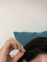 点击看大图 -大麦微针植发丨全国连锁