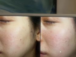 -苑苑vbeauty科技美容SPA