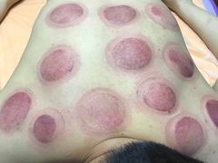 -沈师傅盲人按摩工作室(密三小区店)
