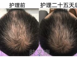 -天其美科学美肤·生发健康管理