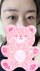 体验后-北京博泽医疗美容门诊部
