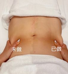 -Fundi张玉珊修身堂·indiba·BTL科技瘦身