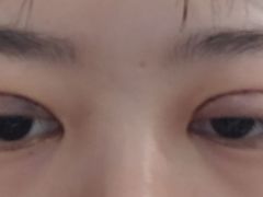 -苏州大学理想眼科医院
