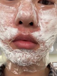 -海涛医疗美容·面部抗衰·注射美鼻