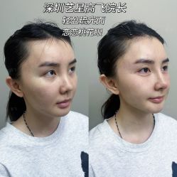 -深圳艺星医疗美容医院