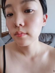 体验后-美莱医学美容医院