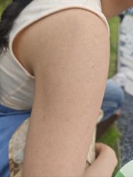 -嘉和医学脱毛中心